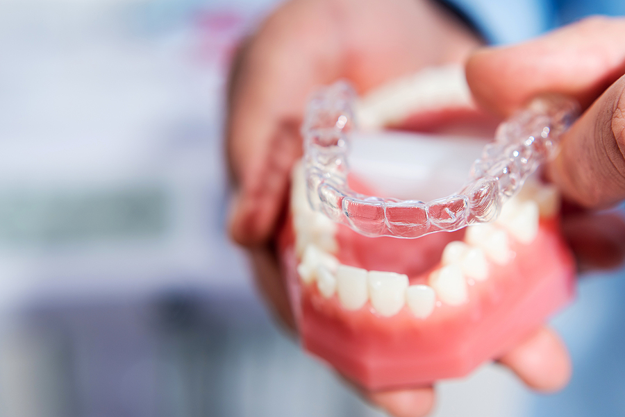 Unlocking Your Smile: Age Requirements for Invisalign Treatment