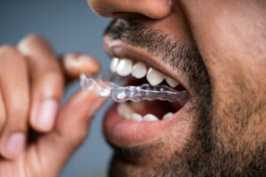 can you eat with Invisalign