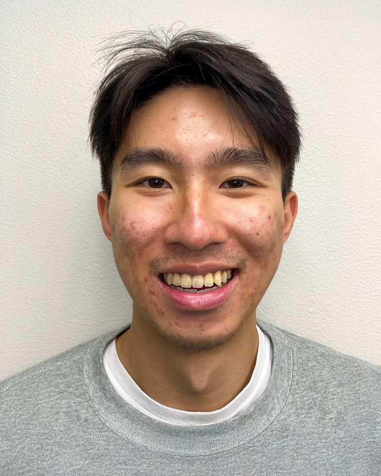 Smiling man after invisalign treatment with Dr. Joseph Phillips in North County San Diego