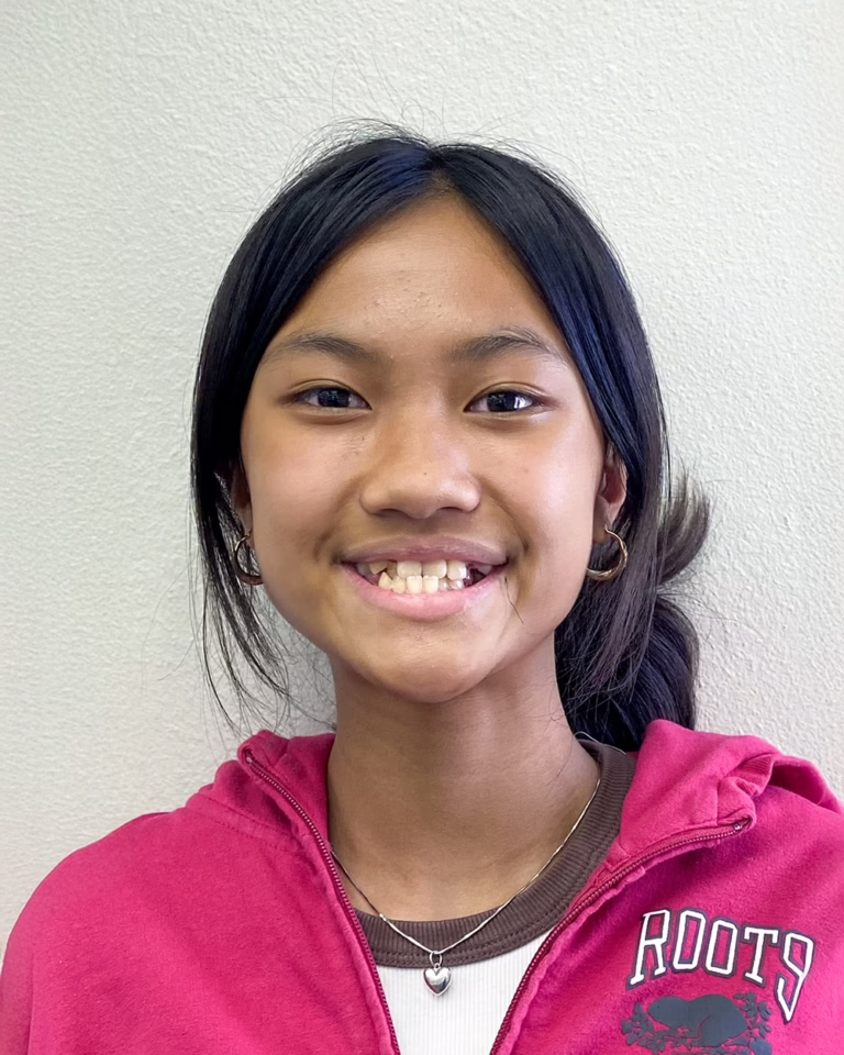 Female patient of Doctor Joseph Phillips smiling after braces in San Diego California