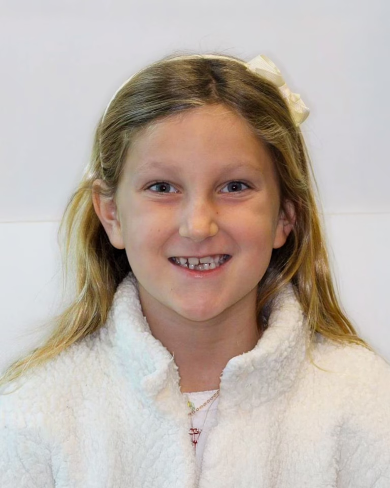 Young girl smiling before treatment with Dr. Joseph Phillips practicing in Encinitas CA